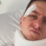 UAE reveals the main reason why Tadej Pogacar had that violent crash in the Vuelta a España